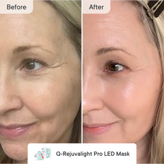 Line Refine Bundle Pro