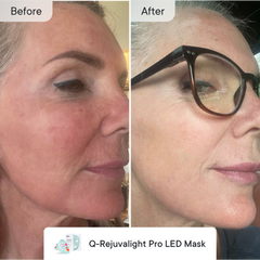 Line Refine Bundle Advanced