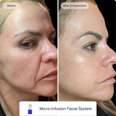Skin Confidence System