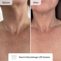 Line Refine Bundle Pro