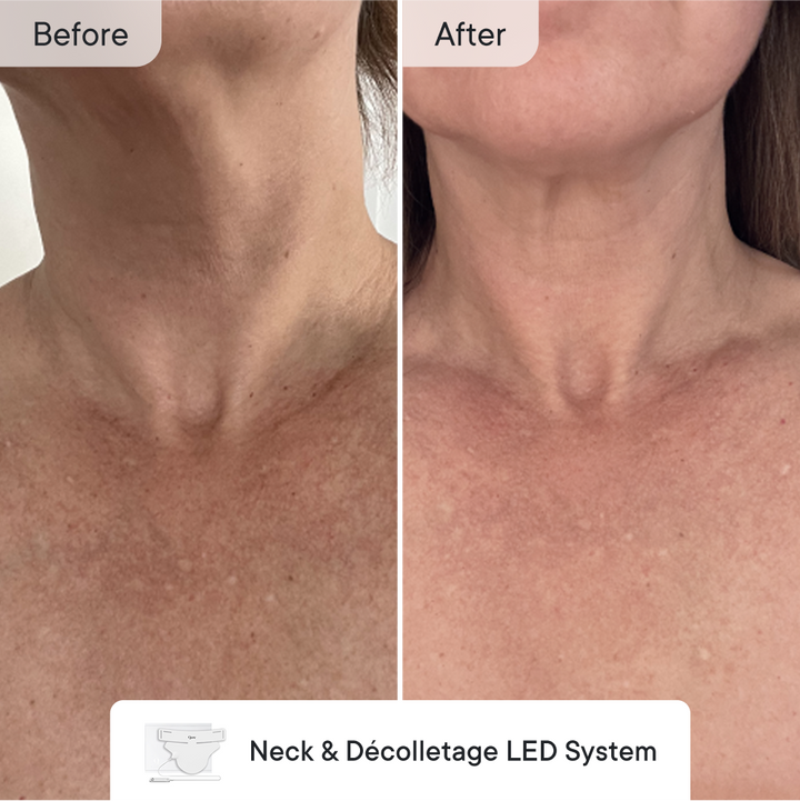 Line Refine Bundle Pro