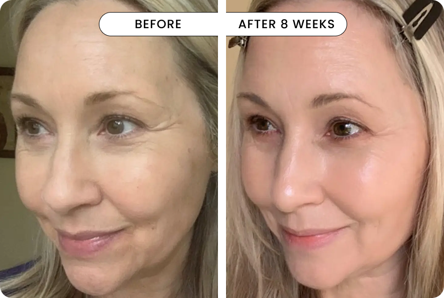 result Q-Rejuvalight Pro Facewear