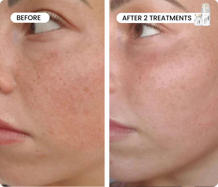Fade & Firm Bundle Advanced