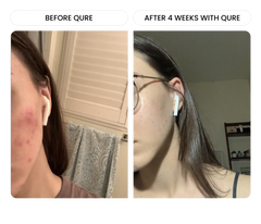All-In-One Face Serum 4 Month Bundle