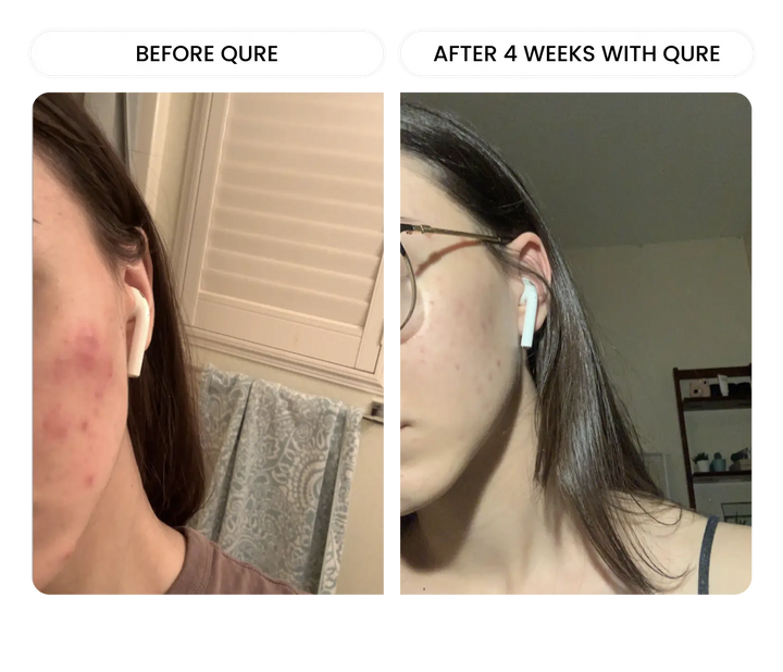 All-In-One Face Serum 4 Month Bundle