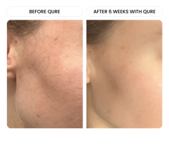 All-In-One Face Serum 4 Month Bundle
