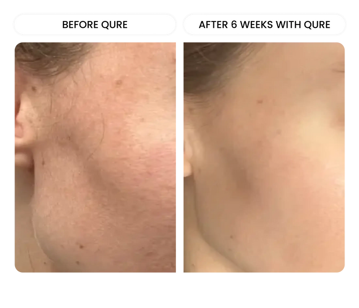 All-In-One Face Serum 4 Month Bundle