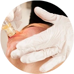In-Clinic Treatment