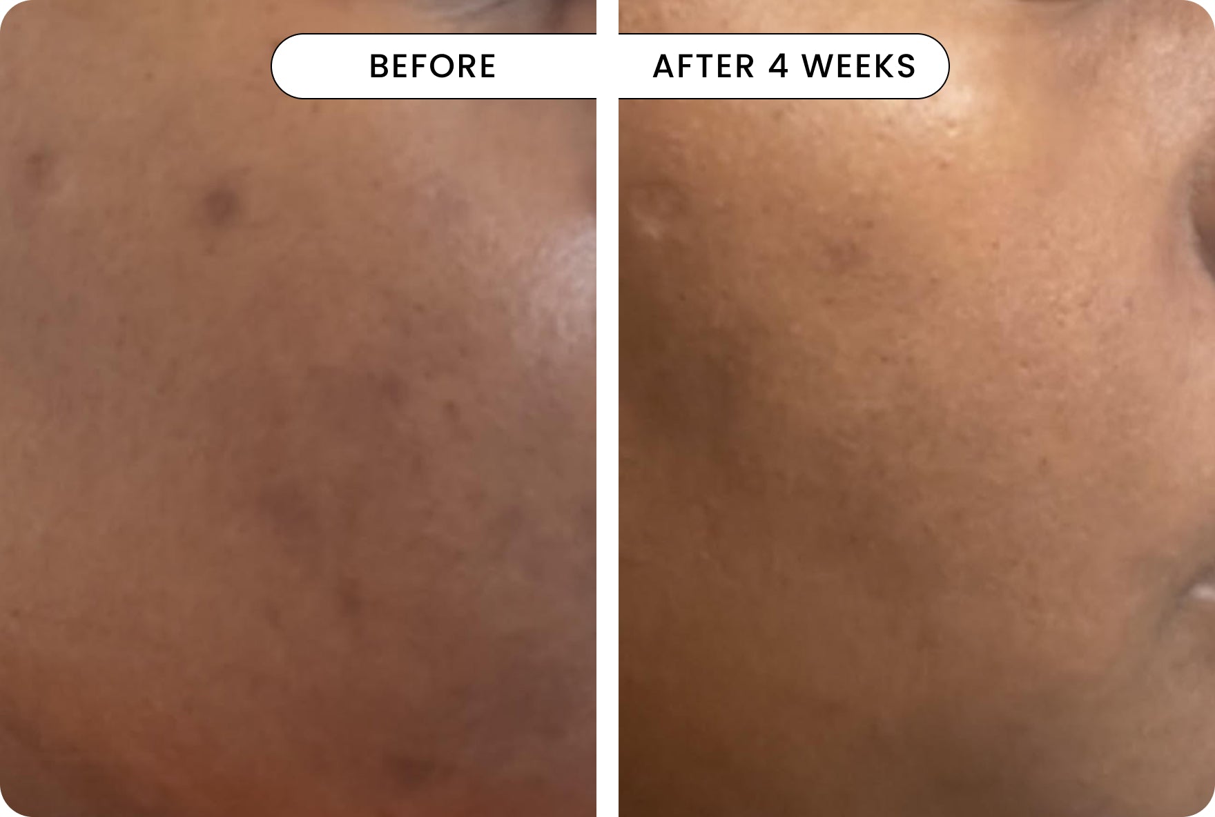 result Q-Rejuvalight Pro Facewear