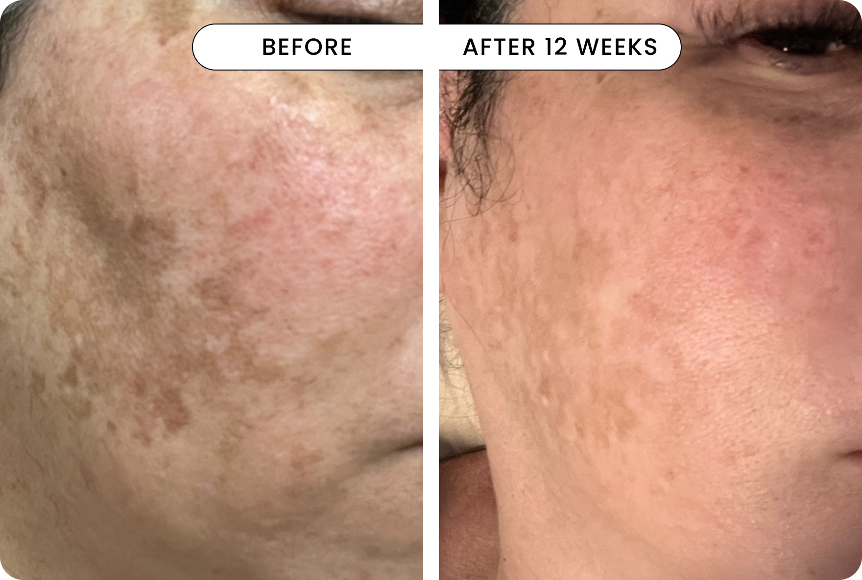 result All-In-One Face Serum