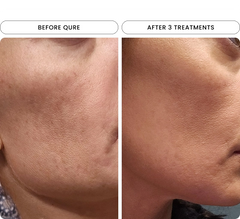 mi_dark_spots_4