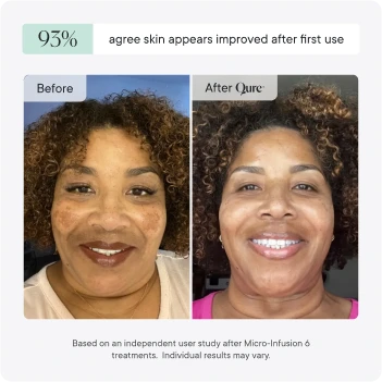 Micro-Infusion 3 Month Bundle (For Dark Spots) (Pre-Order)