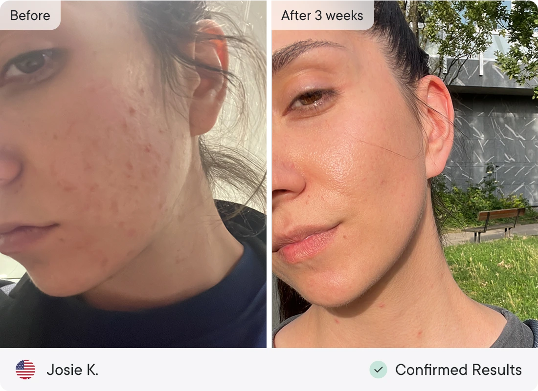 Before & After 3 weeks